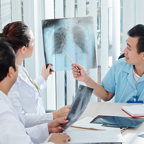 doctors and student discussing lung x-ray