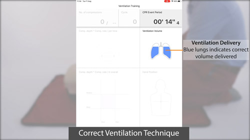 Brayden Online Demo: Ventilation Video